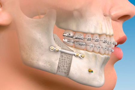 CIRUGÍA MAXILOFACIAL